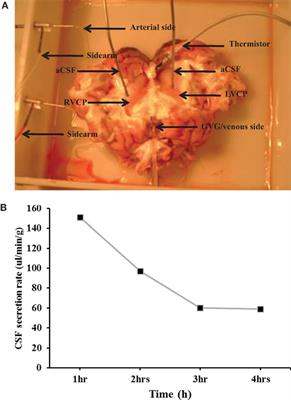 Thyroxine (T4) Transfer from Blood to Cerebrospinal Fluid in Sheep Isolated Perfused Choroid Plexus: Role of Multidrug Resistance-Associated Proteins and Organic Anion Transporting Polypeptides